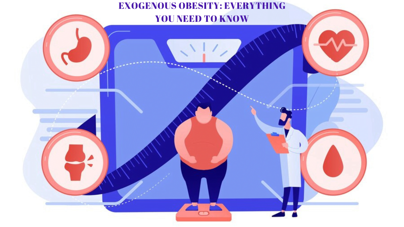 Exogenous Obesity Everything You Need to Know